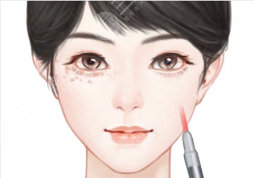 黑眼圈去除手術(shù)