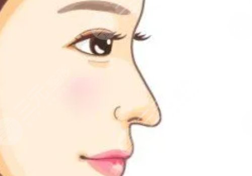 莊蔚強(qiáng)半勒鼻綜合后期恢復(fù)怎么樣