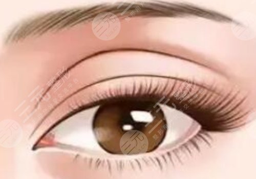 昆明李韜雙眼皮案例