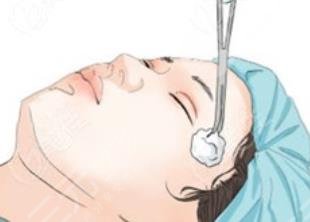 雙眼皮修復(fù)