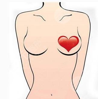 殷初陽醫(yī)生假體隆胸案例