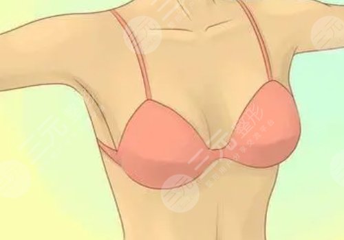 胸下垂做懸吊的前后比較