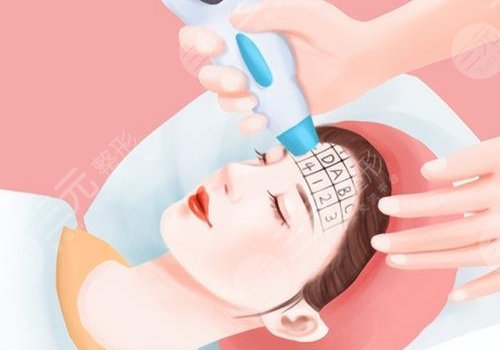 去色素斑用什么藥膏好？