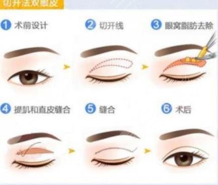 上海華美醫(yī)療美容醫(yī)院擅長(zhǎng)項(xiàng)目