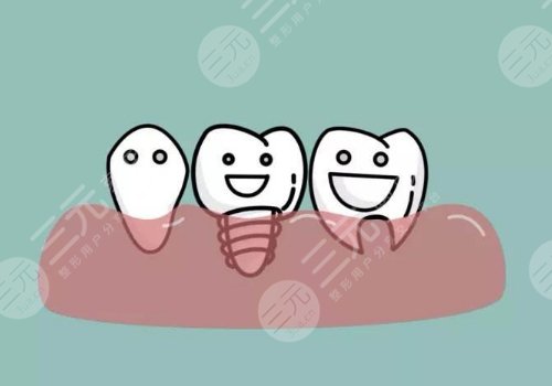 北京安貞醫(yī)院口腔科種植牙怎么樣