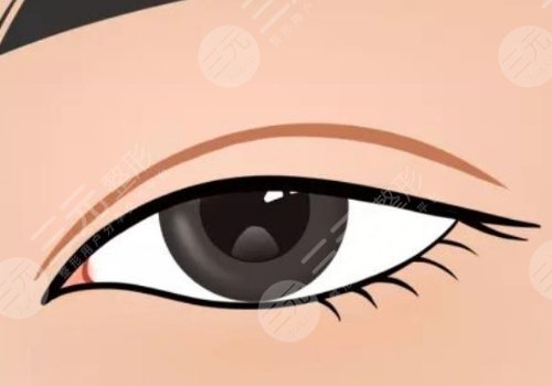 武漢中翰整形外科醫(yī)院付毅怎么樣