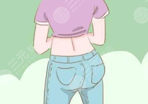 填充臀部一般多少錢