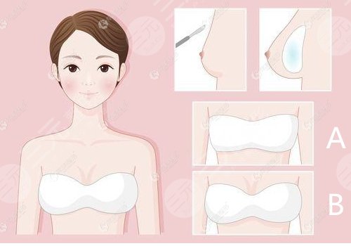 曼托和傲諾拉哪種好