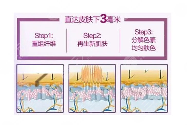 上海華美醫(yī)療美容醫(yī)院祛斑怎么樣