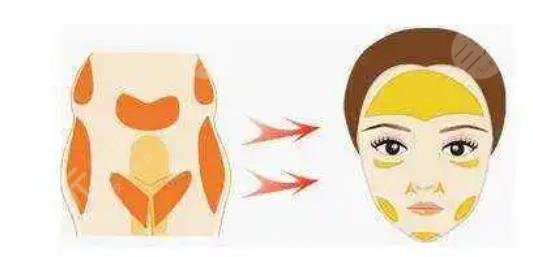 深圳陽光醫(yī)療美容醫(yī)院特色項目