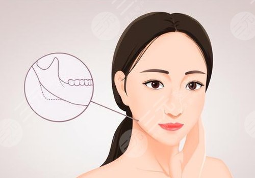 3d下頜角和長(zhǎng)曲線下頜角區(qū)別是什么