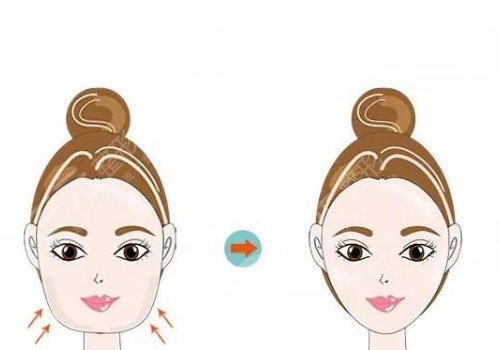 3d下頜角和長(zhǎng)曲線下頜角區(qū)別是什么