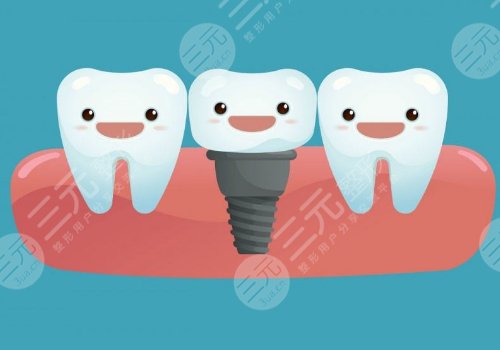 浙江美奧口腔醫(yī)院種植牙怎么樣