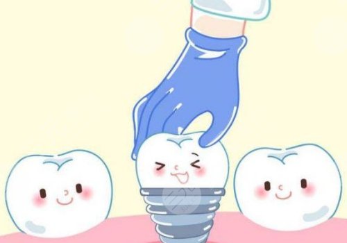 上海美奧口腔醫(yī)院種植牙價(jià)格