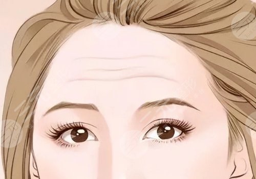 怎么可以消除皺紋