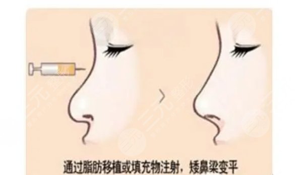 深圳陽光醫(yī)療美容醫(yī)院擅長項目