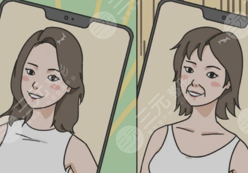 鼻唇溝太深怎么辦