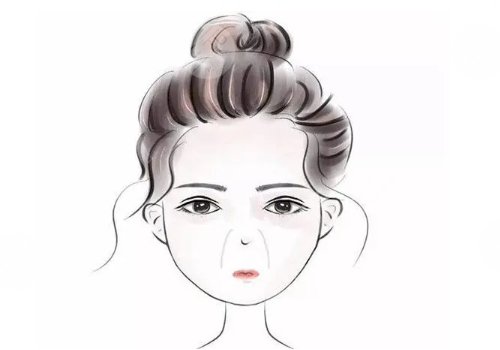 鼻唇溝太深怎么辦