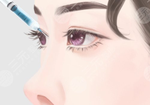 鄭州集美張海洋做鼻子當(dāng)天去可以直接做嗎