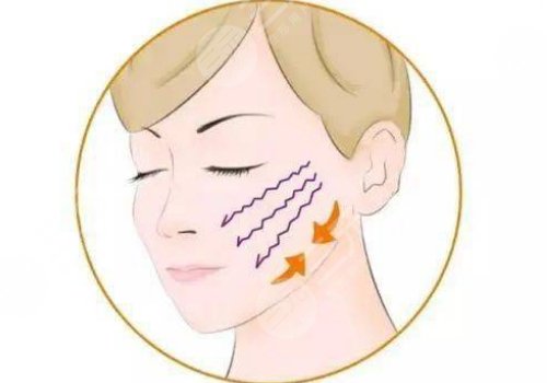 小拉皮手術(shù)可以維持多久