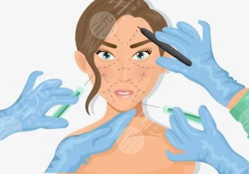 小拉皮手術(shù)可以維持多久