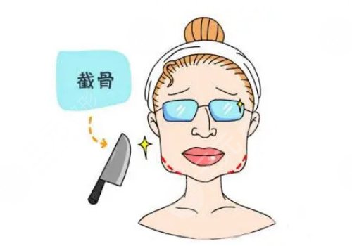 陳小平醫(yī)生磨骨怎么樣