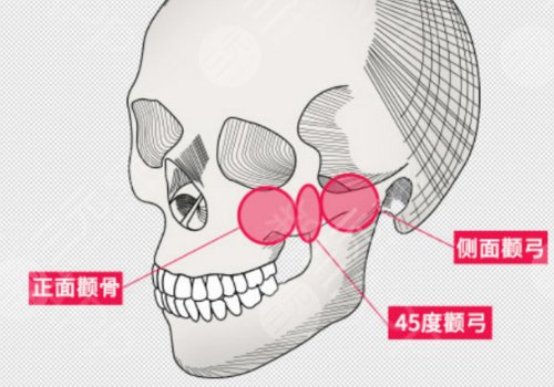 陳小平醫(yī)生磨骨怎么樣