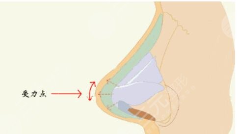 寧波藝星做鼻子醫(yī)生那個(gè)好？盧燕明假體隆鼻結(jié)果分享，寧波隆鼻醫(yī)生合集