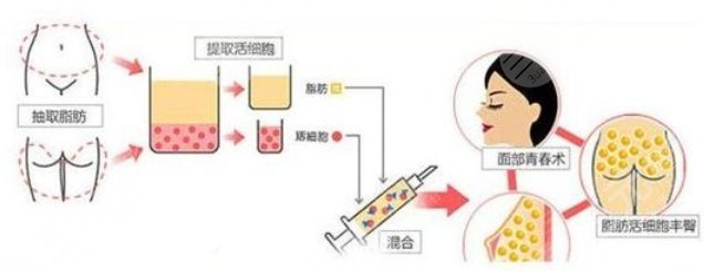活細(xì)胞填充