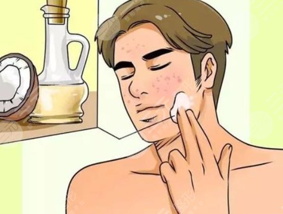 男生美白項(xiàng)目動漫01