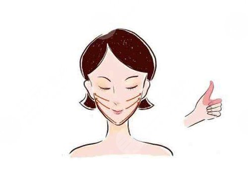 小拉皮怎么做的,手術(shù)切口在哪里