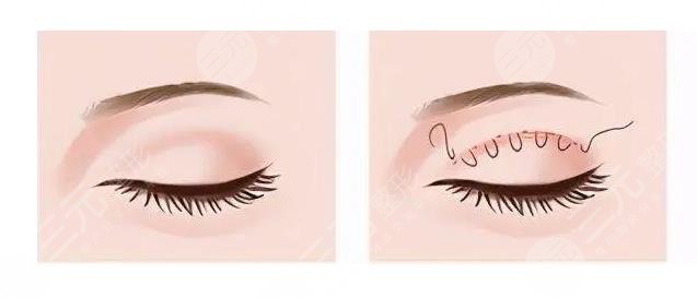 上海八院美容科醫(yī)生專家信息