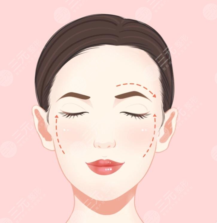 女人做拉皮能管多少年?皮膚科醫(yī)生透露通常維持時(shí)間為3~5年左右