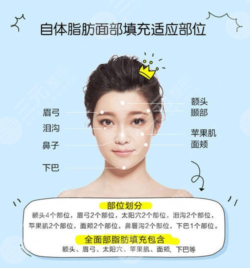 王紹國醫(yī)生做填充嗎