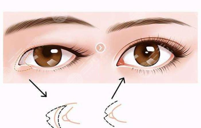 北京田珊山醫(yī)生擅長科普知識