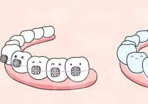 上海尤旦口腔醫(yī)院牙齒矯正怎么樣