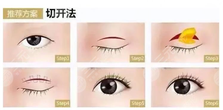 蚌埠醫(yī)學院第一附屬醫(yī)院整形外科特色項目