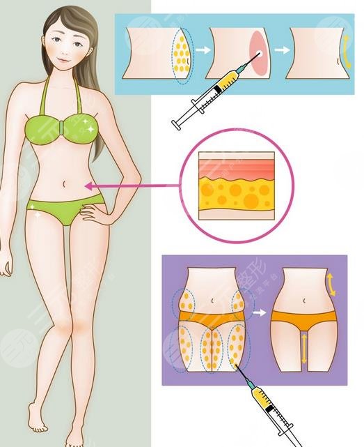 上海八院整形美容科特色項目