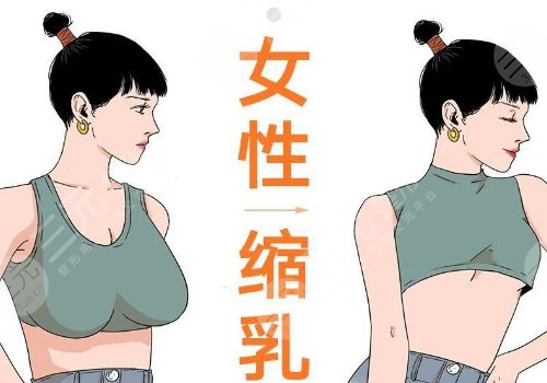 縮胸手術(shù)真實案例前后對比圖案例分享