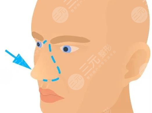 曹海峰醫(yī)生