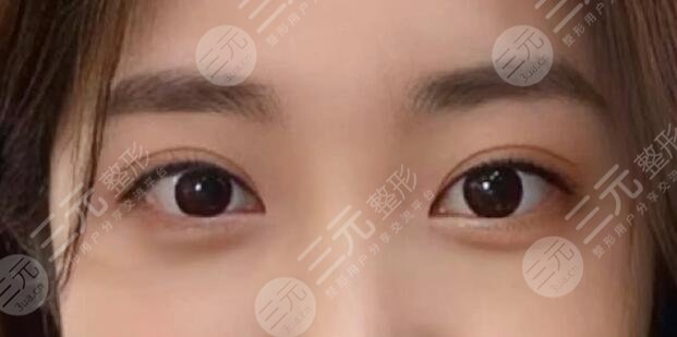 肖貴喜醫(yī)生做雙眼皮怎么樣??？醫(yī)生個人實力測評，就職醫(yī)院是哪家？