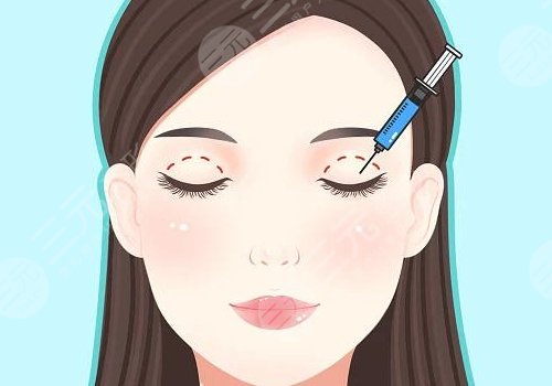 廈門海峽做雙眼皮那個醫(yī)生好