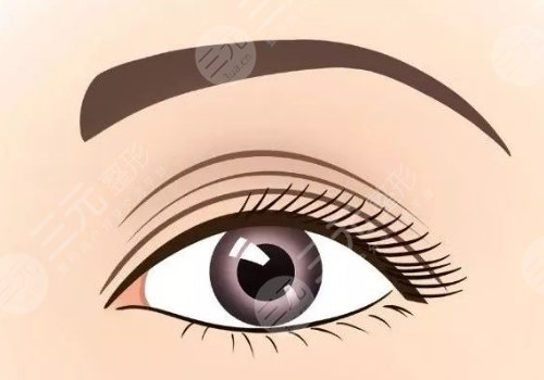 廈門海峽做雙眼皮那個醫(yī)生好