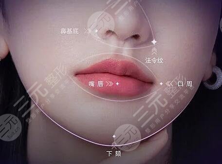 psv面部提升是拉皮嗎？是什么一種技術(shù)？和拉皮的區(qū)別大嗎？