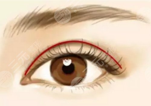 臧夢(mèng)青割雙眼皮怎么樣