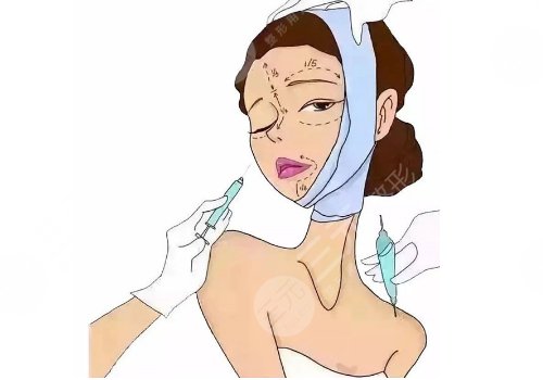 輪廓固定怎么做