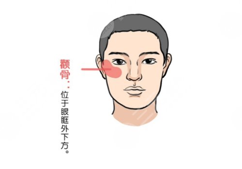 顴骨內(nèi)推多少錢