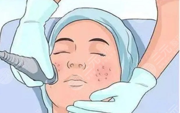 上海第九人民醫(yī)院激光美容科特色項(xiàng)目