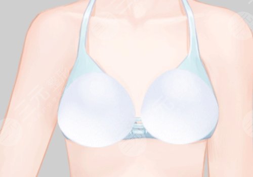 哺乳后的胸怎么恢復彈性