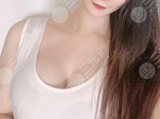 水滴型假體隆胸前后對比效果圖片和手術過程分享，小白隆胸避坑！